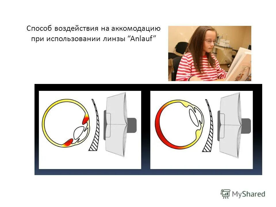 строение оправы для очков. 76 bi-as. очки фото. плюсы и минусы очков. можно ли вернуть линзы в оптику.