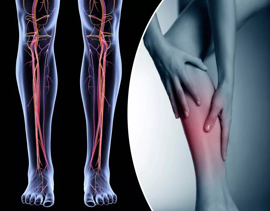 кто лечит сосуды