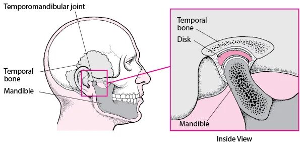 Из за чего может болеть челюсть. Анатомия сустава ВНЧС. Синдром болевой дисфункции ВНЧС. Мышечная дисфункция ВНЧС. Дисфункция височно-нижнечелюстного сустава.