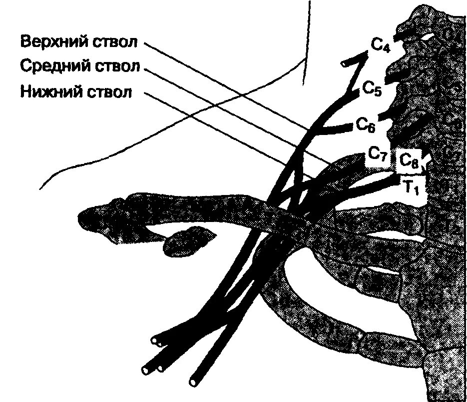 Блокада сплетения. УЗИ плечевого сплетения методика. УЗИ стволов плечевого сплетения. Межлестничная блокада плечевого сплетения методика. Блокада плечевого сплетения анатомия.
