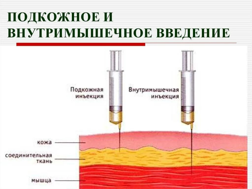 Подкожно внутрикожно внутримышечно. Схема внутримышечных инъекций масляных растворов. инъекции внутрикожно подкожно внутримышечно. иглы для внутримышечных инъекций в ягодицу. внутримышечное и подкожное введение.