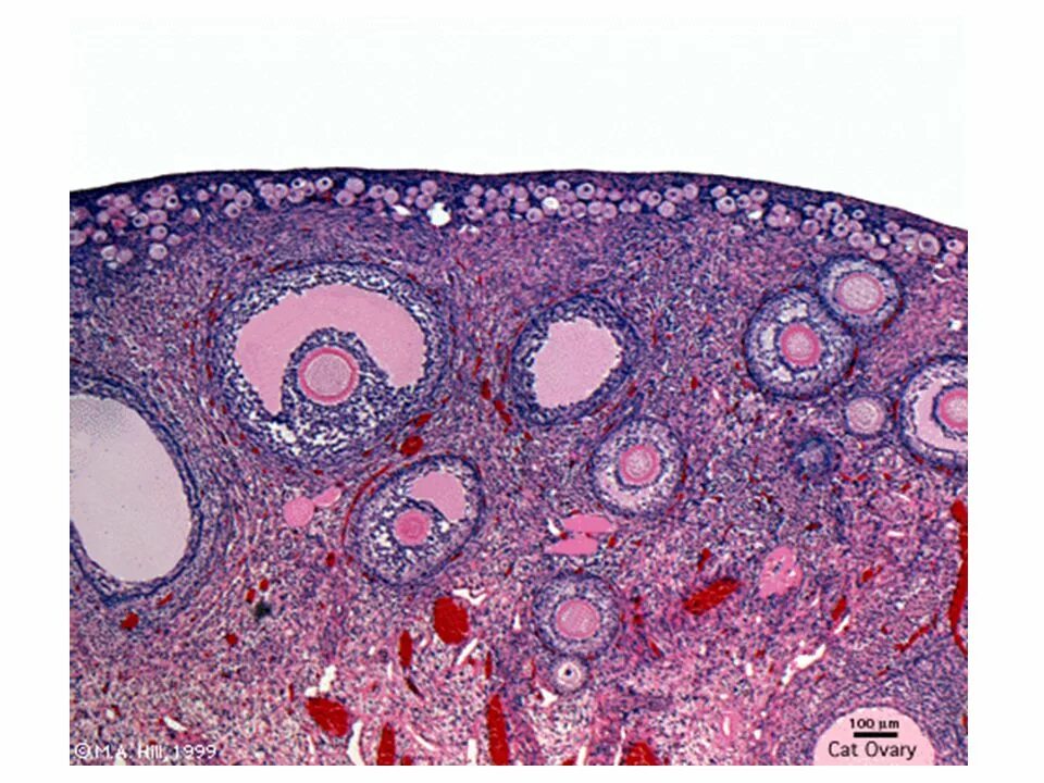 Яичник гистология препарат. Яичник млекопитающего гистология. Фолликулы яичника гистология. Фолликул фаза