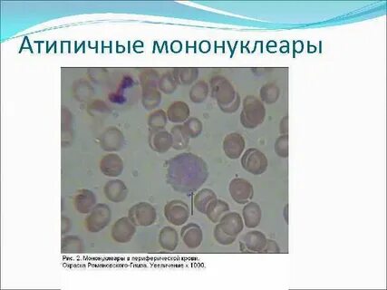 Атипичные