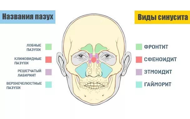 Болит переносица при нажатии насморка. Строение гайморовых пазух.