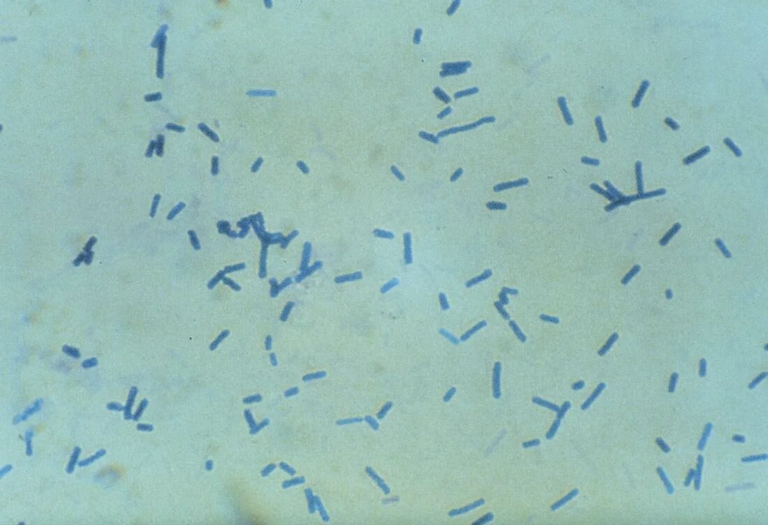 Cutibacterium acnes. Бактериями Cutibacterium acnes. Пропионобактерии акне.