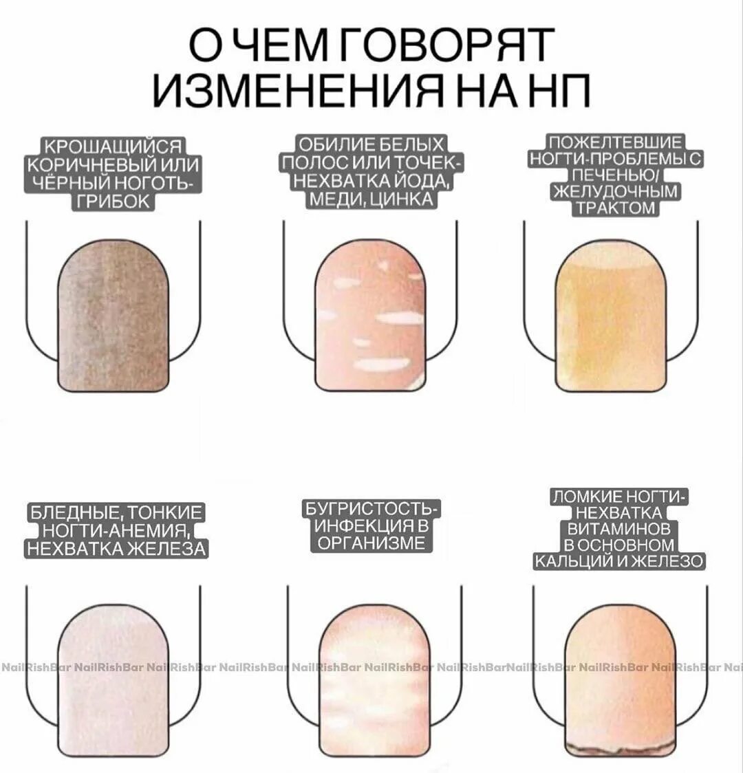 Как определить по цвету ногтей заболевание. Признаки болезней по ногтям. Диагностика по ногтям. Диагностика заболеваний по ногтям на руках. Заболевания по ногтям рук.