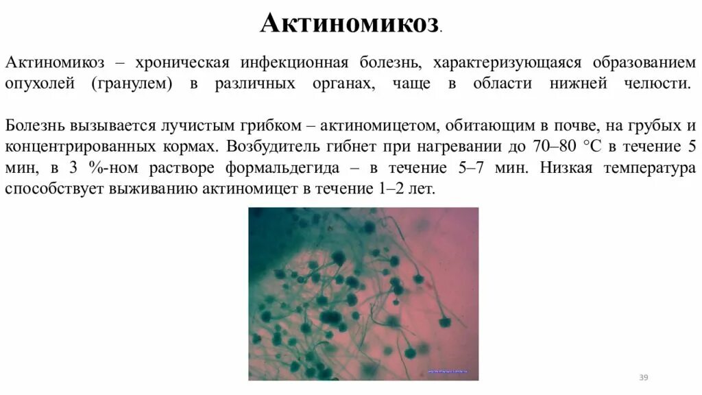 Актиномикоз это. Актиномицеты микробиология возбудители. возбудитель актиномикоза микробиология. актиномикозные гранулемы. микроскопически актиномикоз характеризуется.