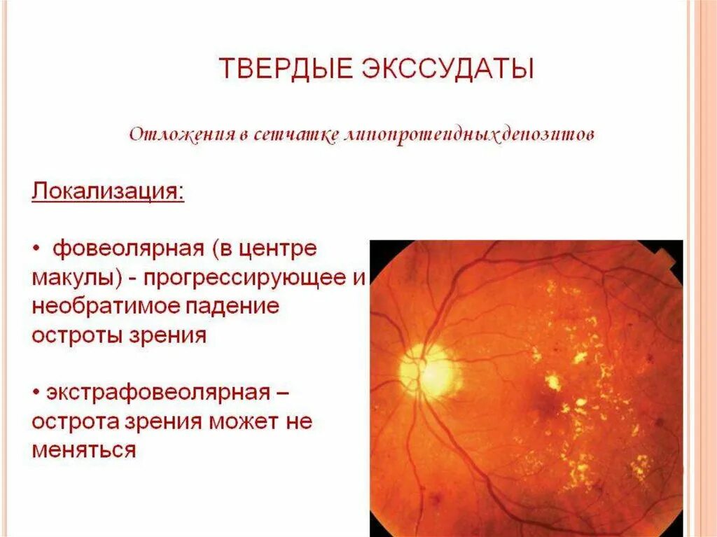 Фовеолярный эпителий желудка гистология. Признаки гиперплазии желудка. Признаки гиперплазии желудка. Признаки гиперплазии желудка. Осложнения хронического атрофического гастрита.