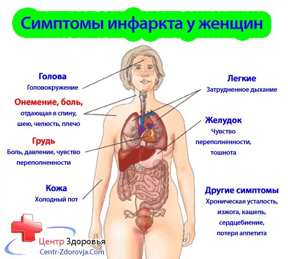 Признаки сердечного приступа у женщин после 40. Инфаркт симптомы. признаки инфаркта у женщины. проявление инфаркта у женщин. признаки сердечного приступа у женщин.