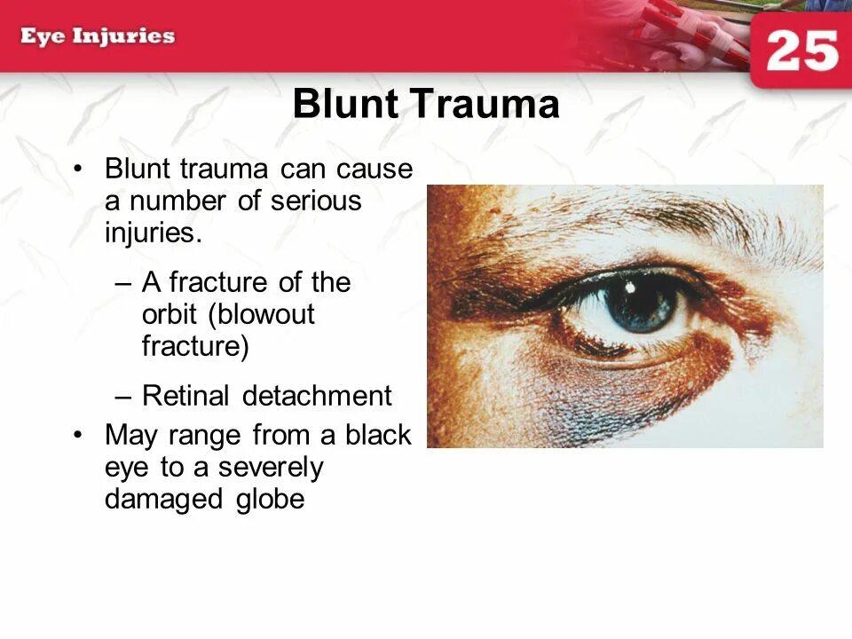 Trauma перевод. Grading of Blunt Aortic injury/Trauma.