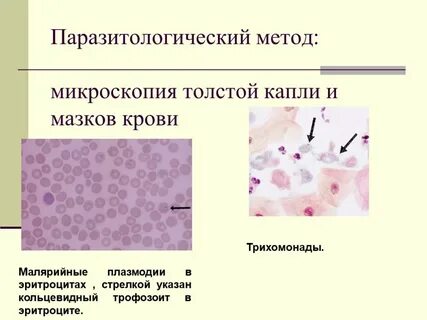 Метод толстого мазка