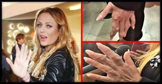 юлия началова подагра на ногах. пальцы ног юлии началовой. юлия началова 2019 ноги. подагра у юлии началовой ноги. подагра на руках юлии началовой.