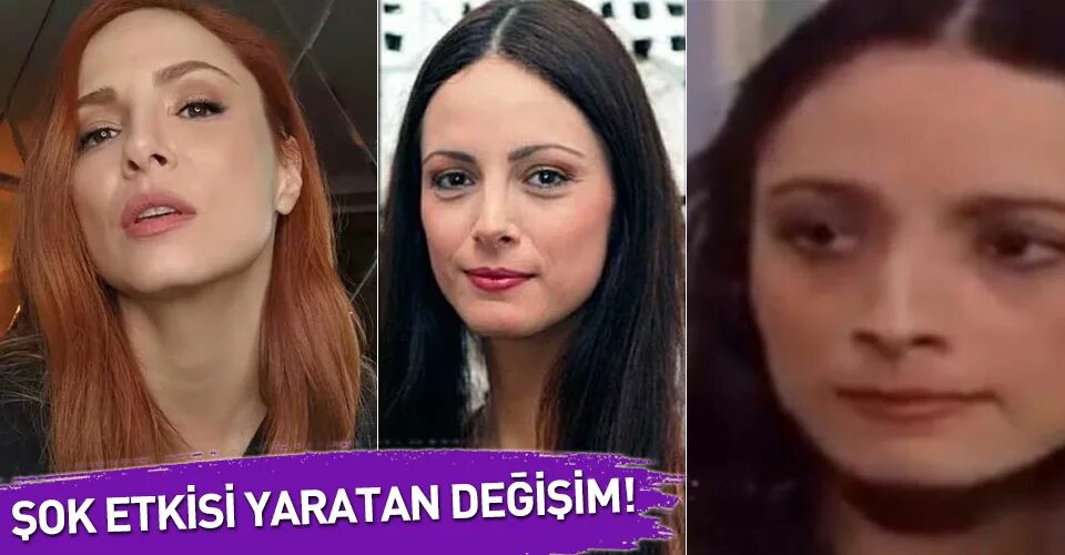 Мине тугай в молодости. Мине тугай пластика до и после. Мине тугай пластика. Мине тугай до пластики. Мине тугай до пластики в молодости.