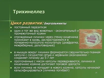 Лечение трихинеллеза