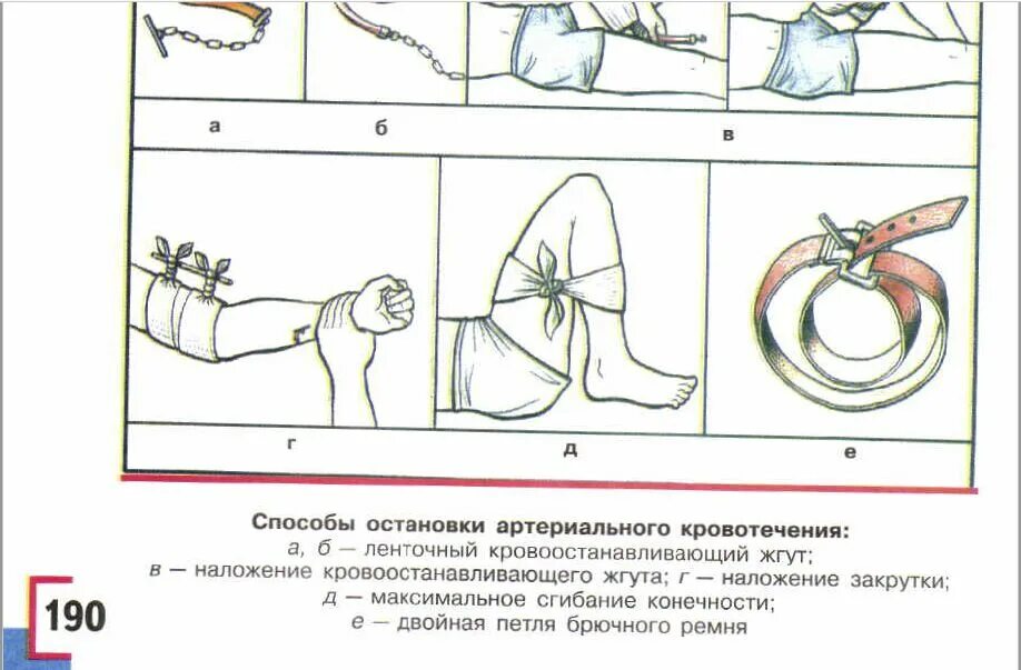 Какой способ остановки артериального кровотечения наиболее. Жгут кровоостанавливающий для артериального кровотечения. Жгут кровоостанавливающий для остановки артериального кровотечения. Метод остановки артериального кровотечения. Способ первичной остановки артериального кровотечения.