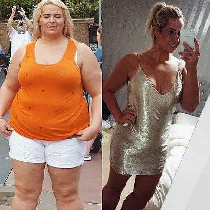 Большие девочки до и после похудения. Похудение до и после. До и после похудения женщины. До и после похудения в одежде. Похудела до и после.