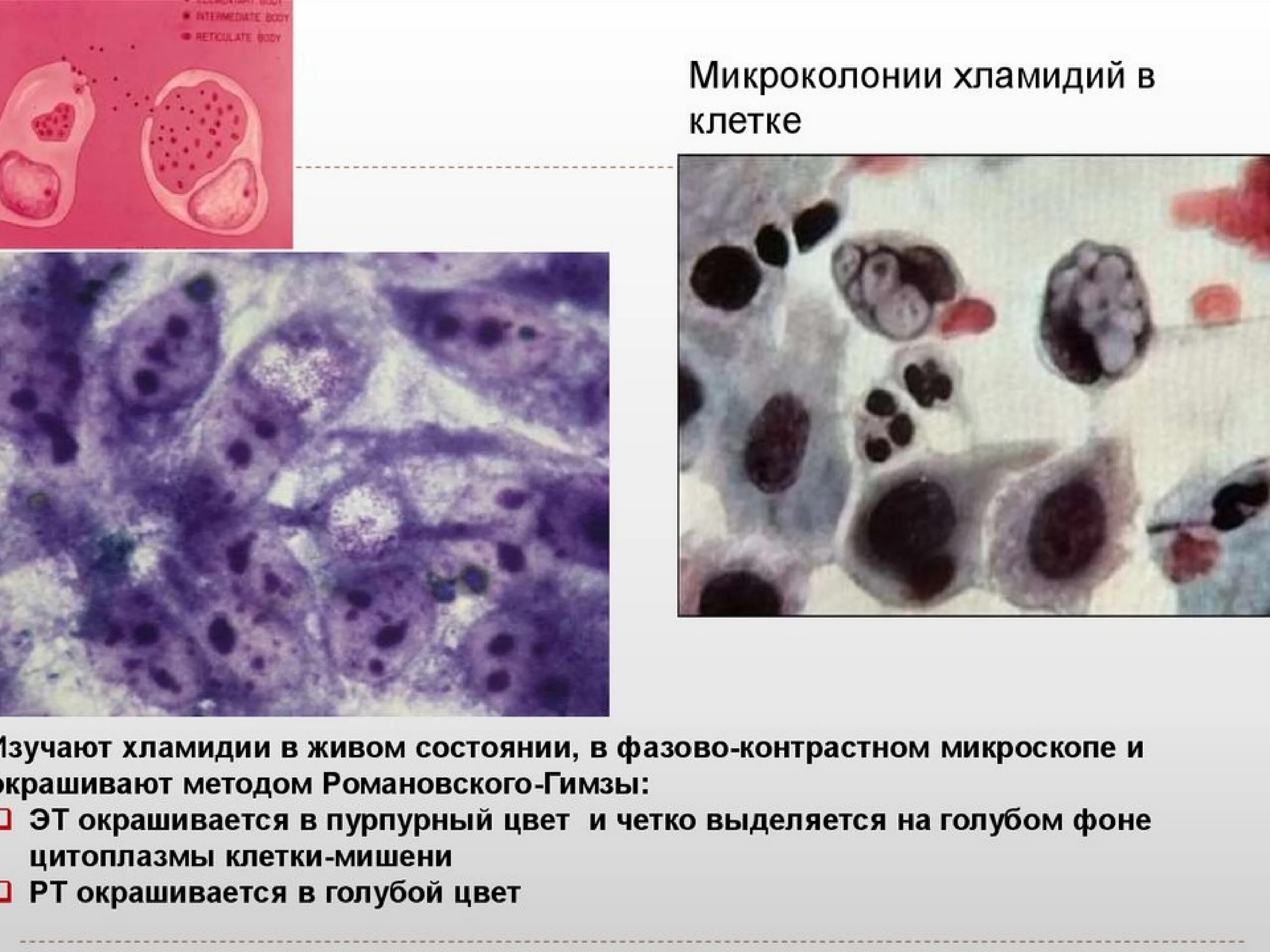 Цена хламидиоза. Хламидии Романовскому Гимзе. Романовский Гимза окраска хламидии. Риккетсии хламидии микоплазмы. Chlamydia trachomatis микроскопия.