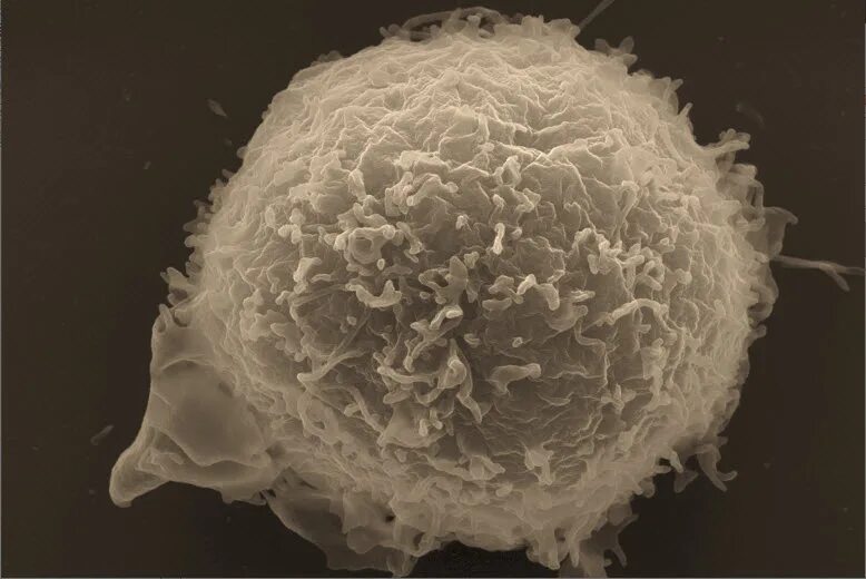 Лекарства фото. Правила личной гигиены при посещении сауны. Порожает. Воспаление половых клеток фото. Правила личной гигиены грибковые заболевания.