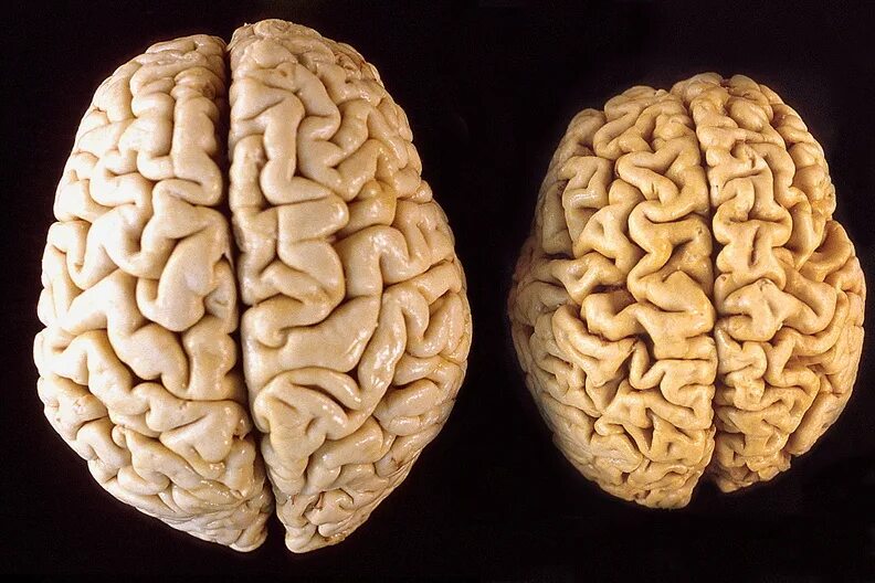 Гениальные мозги