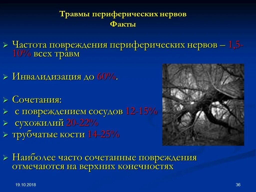 Сочетание повреждения. Клиника повреждения периферического нерва. Повреждение периферических нервов. Травматические повреждения периферических нервов. Механизмы повреждения периферических нервов.