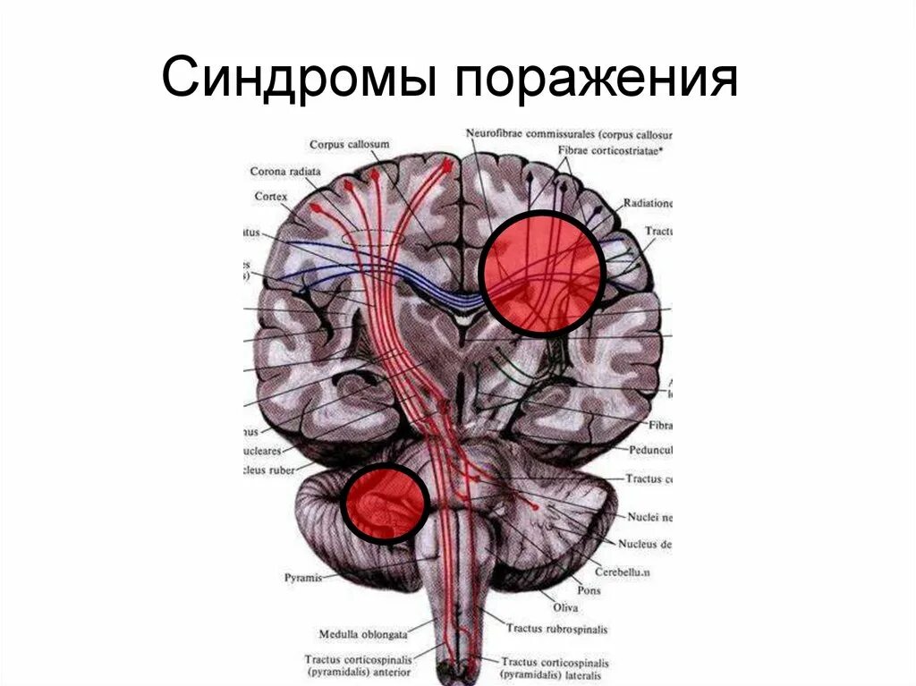 Двигательная сфера виды. Синдромы поражения двигательной сферы. синдромы поражения двигательных структур. двигательная и чувствительная сфера, синдромы поражения. рефлекторная сфера неврология.