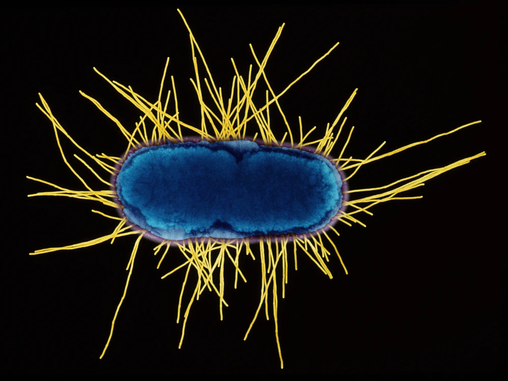 Рубцовые бактерии. Микробные клетки e. coli. Макет бактерии. Модель бактерии. Бактериальная клетка под микроскопом.
