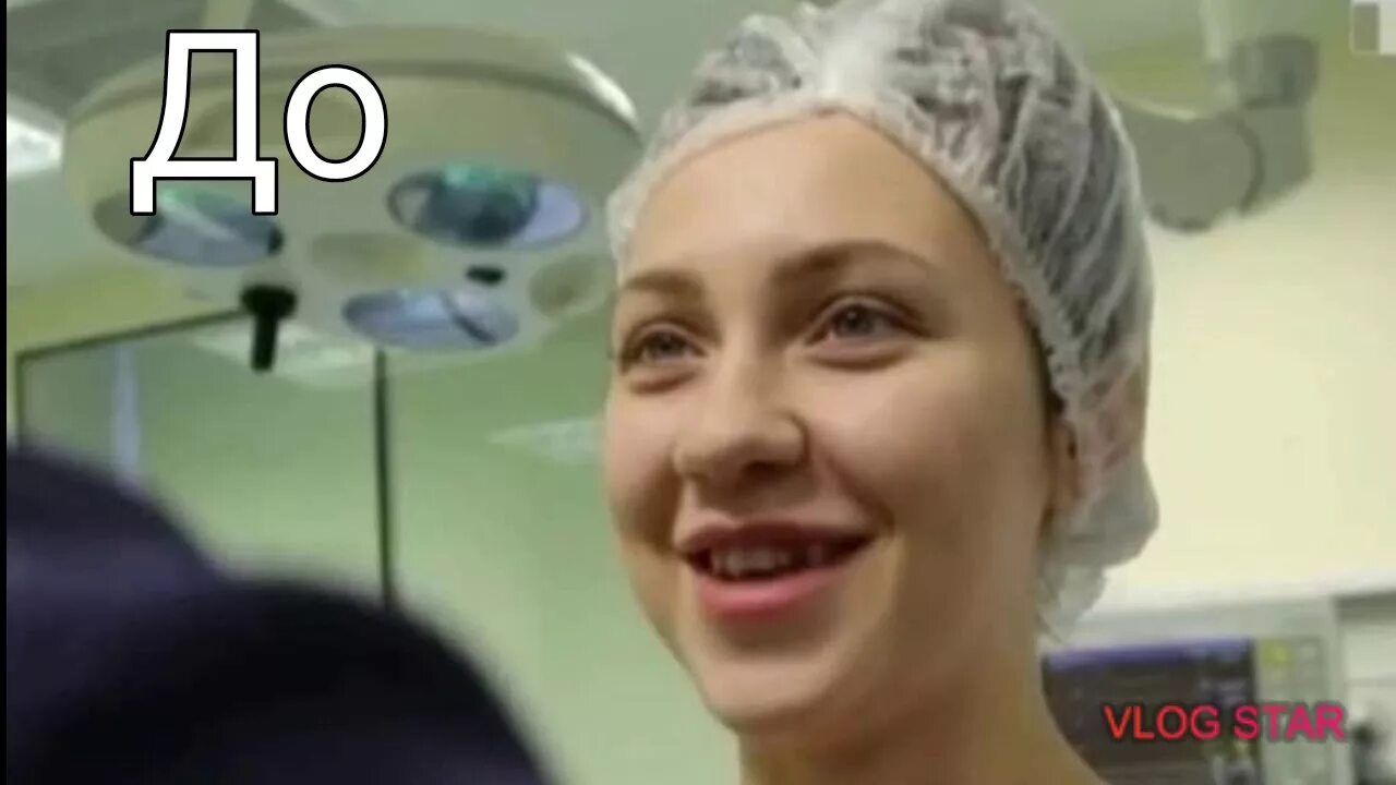 Дом два нос. Зубы алены рапунцель дом 2. алёна савкина нос. алена савкина зубы. алёна савкина зубы до и после.