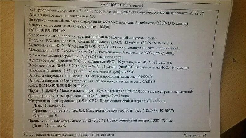Заключение ЭКГ. Холтер заключение врача. Холтер ЭКГ заключение. Заключение врача по СМАД.