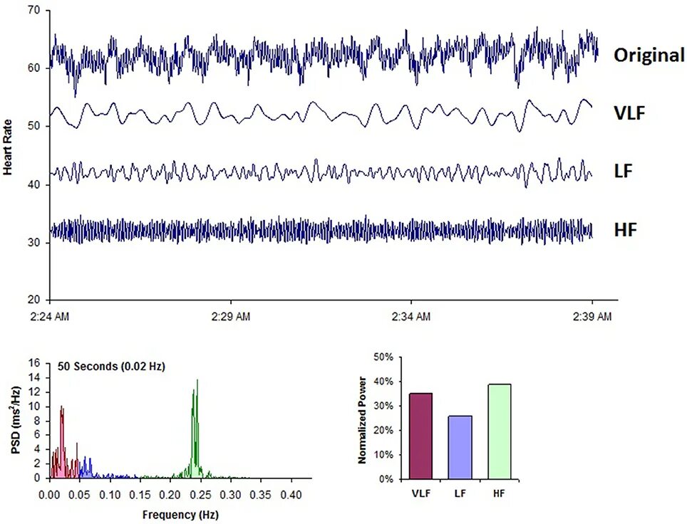 Rate variability. Heart rate variability. variability.
