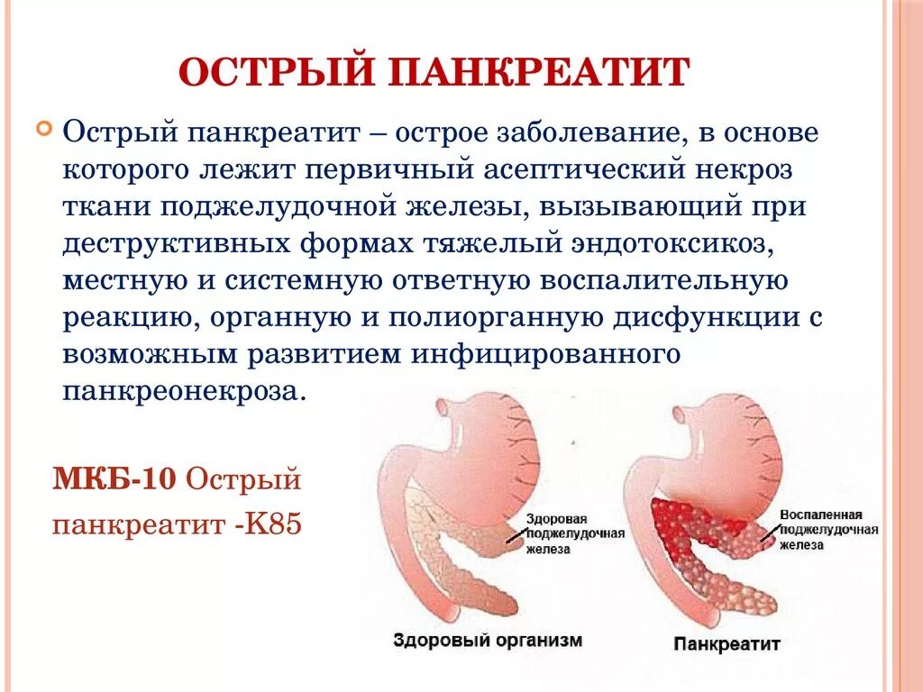 Острый и хронический панкреатит. Панкреатит поджелудочной железы. Острое воспаление поджелудочной. Панкреатит происхождение