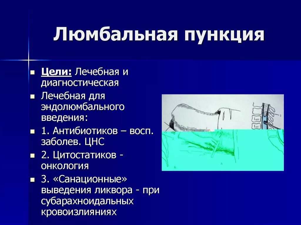 Сколько делают пункцию. Техника проведения пункции ликвора. Техника введения спинномозговой пункции. Диагностическая пункция спинного мозга. Люмбальная пункция лечебная цель.