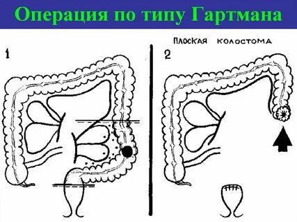 Операции 2 типа