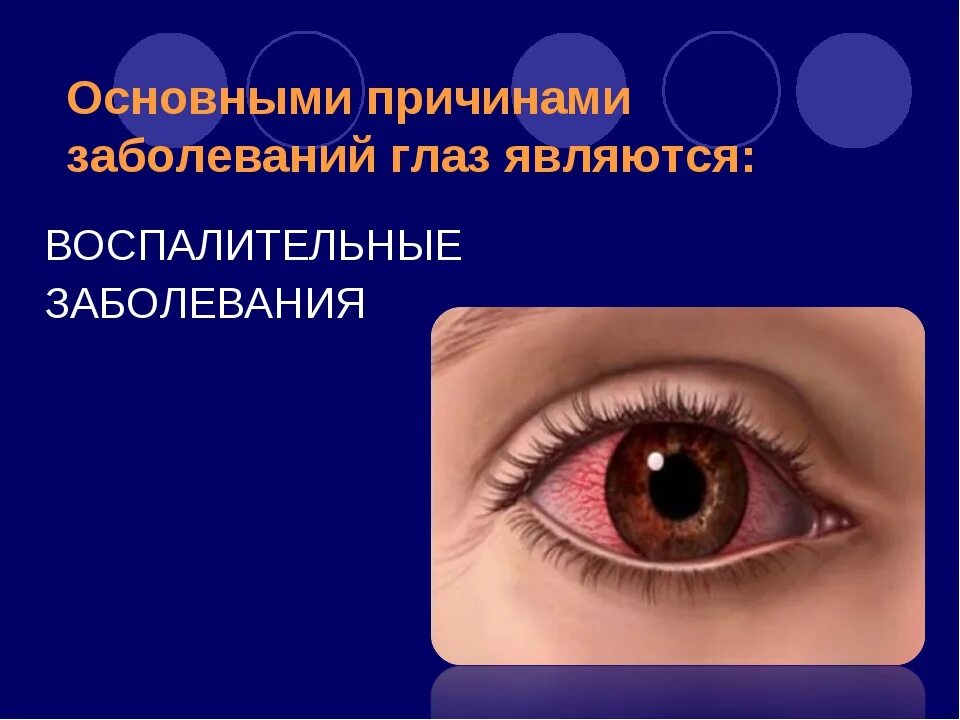 Перечень заболеваний глаз. Воспалительные заболевания глаз. Заболевания глаз список. Заболевание глаз у человека список. Нарушение глаза