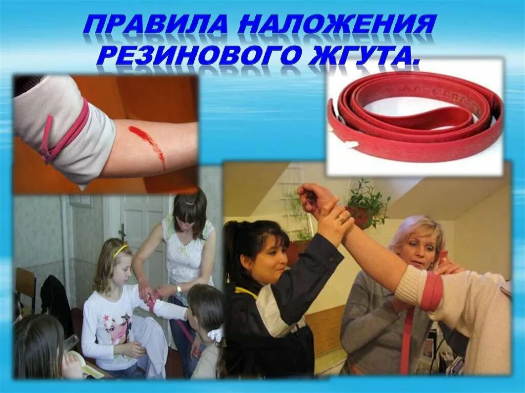 В качестве импровизированного жгута можно использовать. Кровоостанавливающий жгут накладывают:. наложение резинового жгута.
