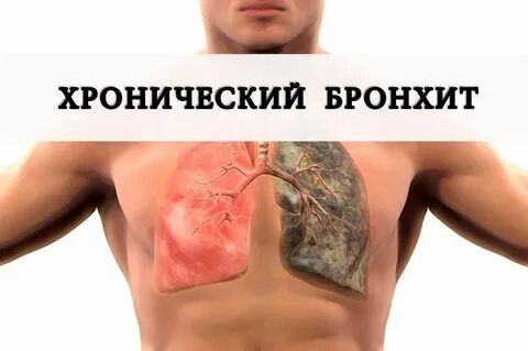 Где лечить легкие