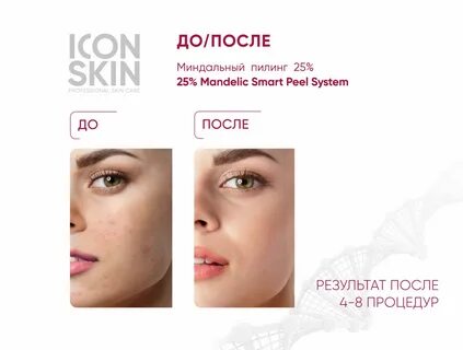 Icon миндальный пилинг 25