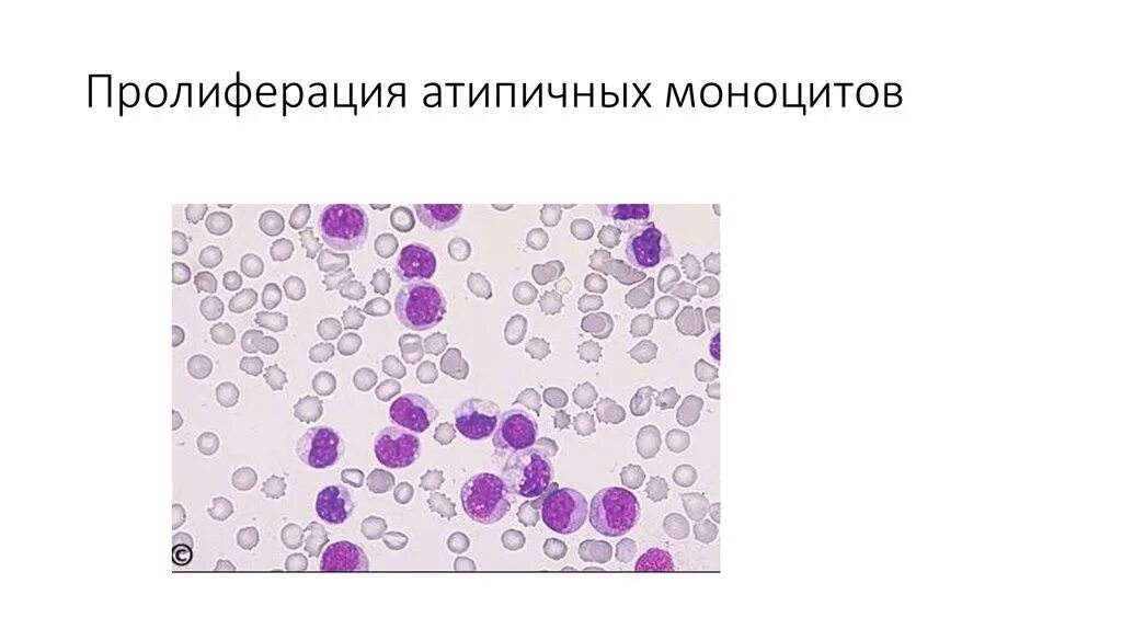 Пролиферация это простыми словами. Лимфоклеточная пролиферация. Пролиферация клеток. Пролиферация цитология. Пролиферация клетокто.