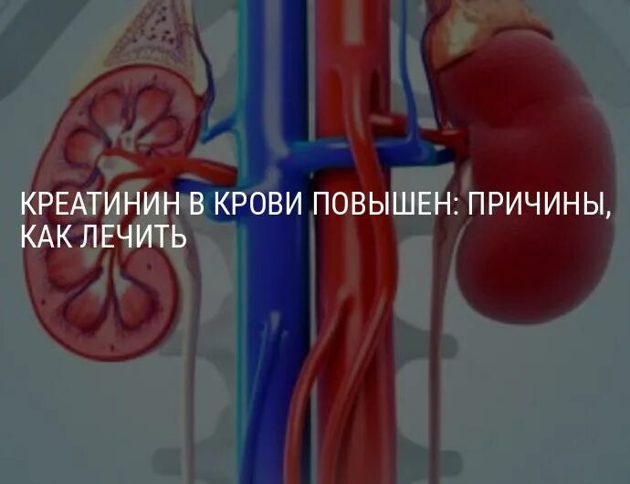 Повышение креатинина. Креатинин крови 102. Креатинин 125.7. Креатинин почки. Креатинин почки повышен.