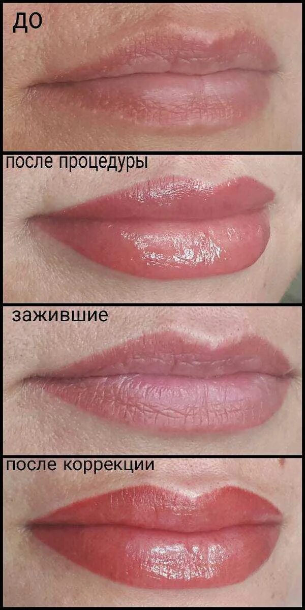 Перманент губ. Губы после перманентного макияжа. Перманентный макияж губ до и после. Заживший перманент губ натуральный. Чем мазать губы после перманентного макияжа.