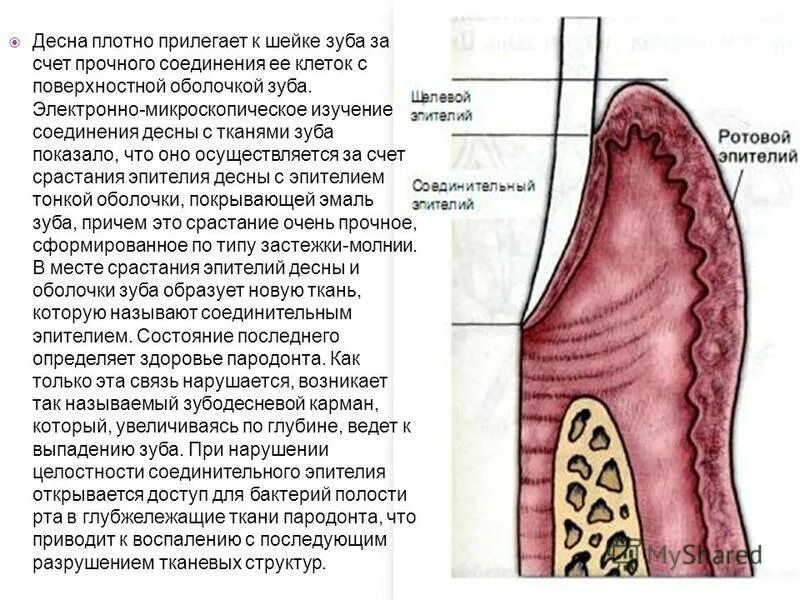 Десна оболочки. Строение десны человека. Десна оболочки. Десна оболочки. Строение десны гистология.