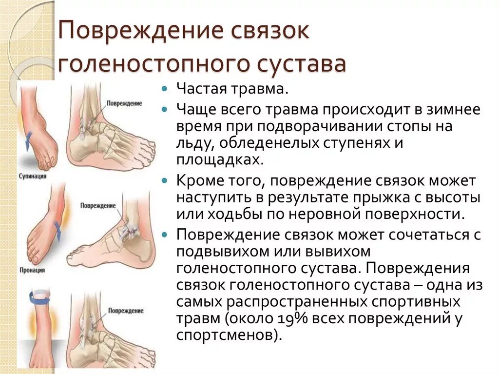 Кса голеностопного сустава