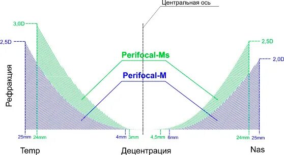 Без перифокальной реакции. Линзы перифокал. Perifocal-MS линзы. Линзы Перифокалы для очков. Линзы Perifocal производитель.