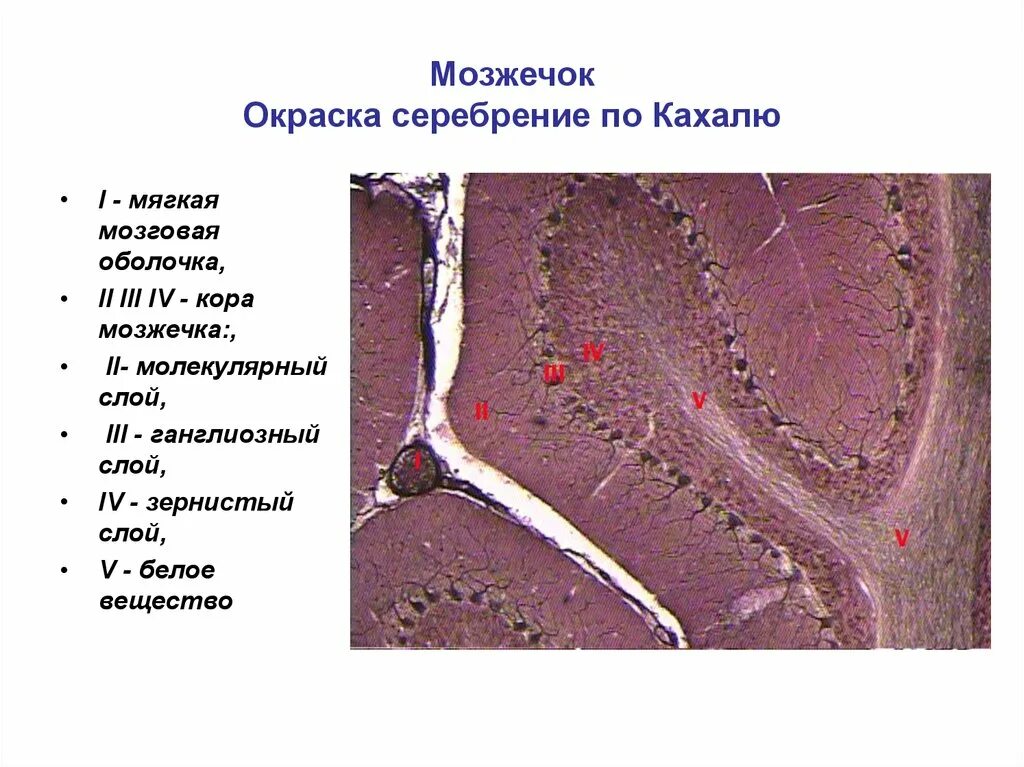 Ткань мозжечка. Мозжечок гистология препарат. Мягкая мозговая оболочка мозжечка гистология.