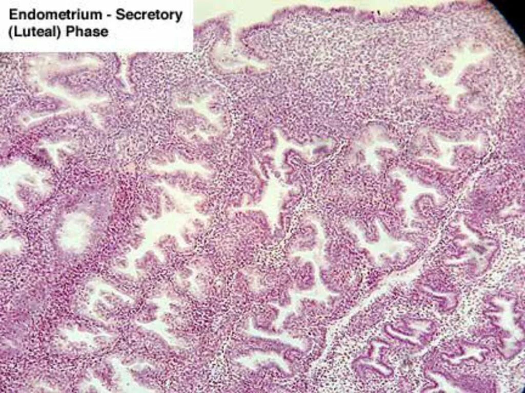 Гистология при беременности. Секреторный эндометрий гистология. Эндометрий секреторного типа гистология. Гравидарный эндометрий гистология. Гистология эндометрия.