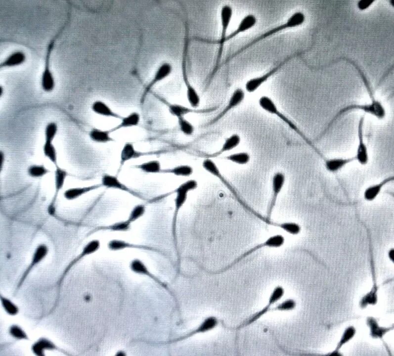 Сперматозоид под микроскопом. Спермограмма микроскоп. Сперматазоид под микроскоб. Сперматозоид в микроскопе. Конча что это