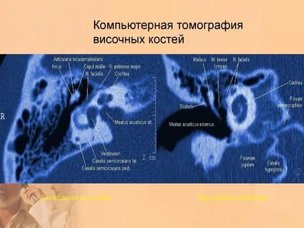 Кт уха