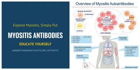 Myositis латынь