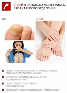 От грибка и запаха ног