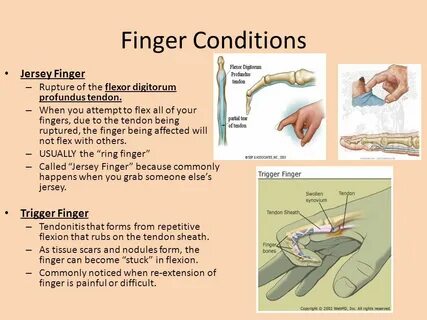 Finger being in the