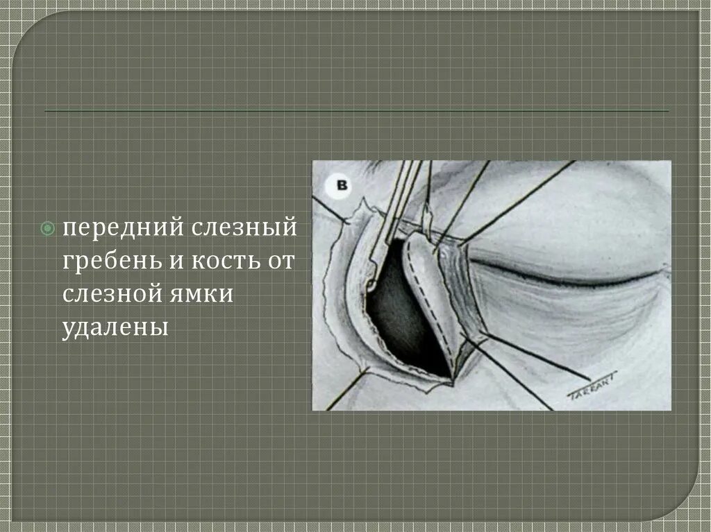 Что такое зно кожи века - фото презентация